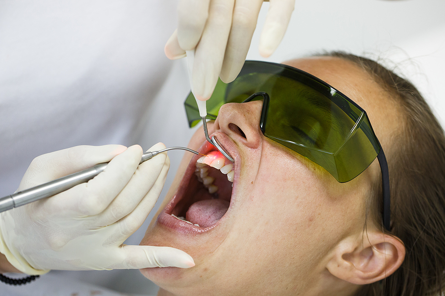The Future of Dental Care: Exploring Laser Dentistry in Colorado Springs, CO