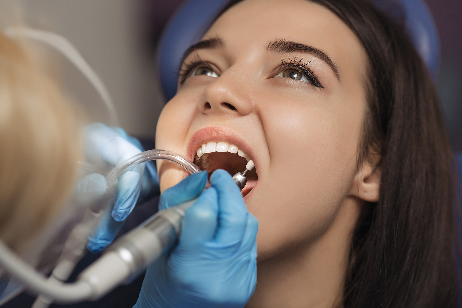 What to Expect After a Root Canal: A Day-by-Day Recovery Guide